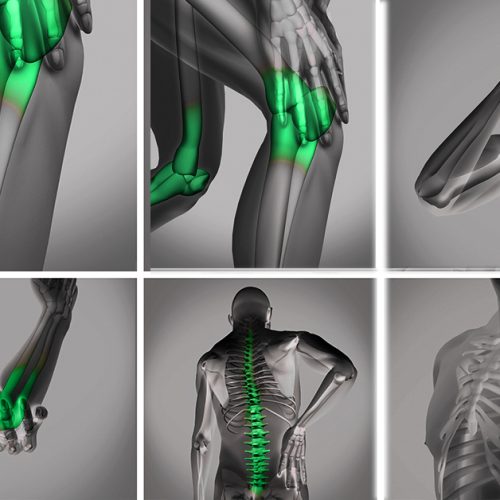 What-is-Pain-main 2 درد مزمن چیست و چرا گاهی سالها ادامه پیدا میکند؟