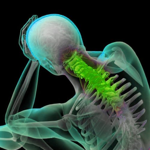 neck-pain-and-head-pain-connection- گردن درد و سردرد؛ ارتباطی که نباید نادیده گرفت