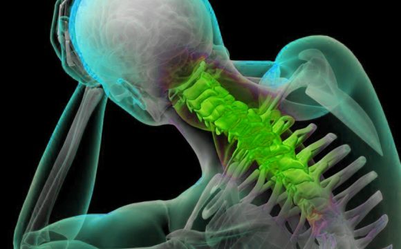 neck-pain-and-head-pain-connection- گردن درد و سردرد؛ ارتباطی که نباید نادیده گرفت