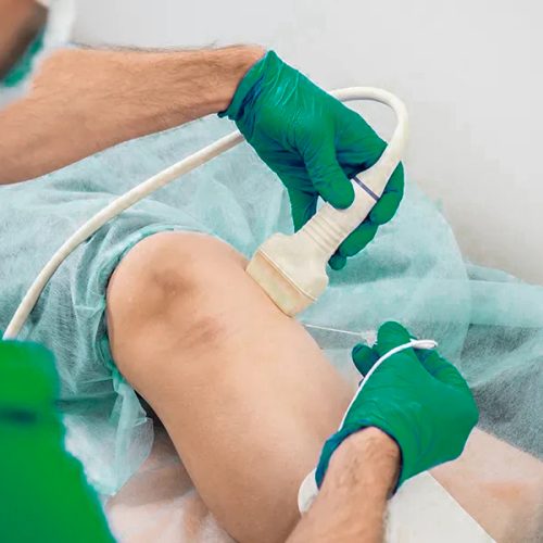 Intra-articular Injection تزریقات داخل مفصلی