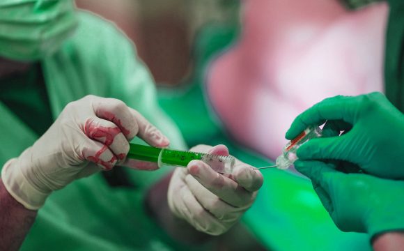 Nerve Block title انواع بلاک های عصبی برای درمان درهای مزمن