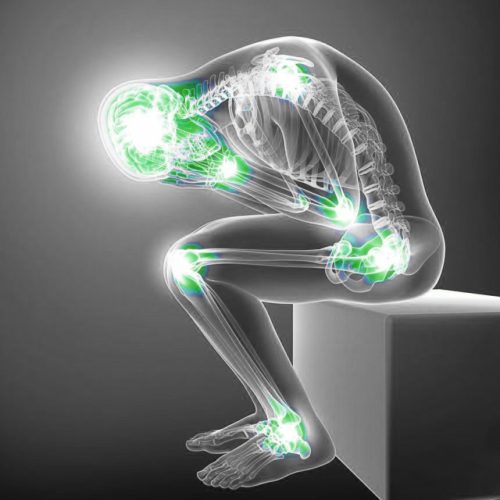 Fibromyalgia فیبرومیالژیا؛ وقتی درد همهجای بدن را درگیر میکند