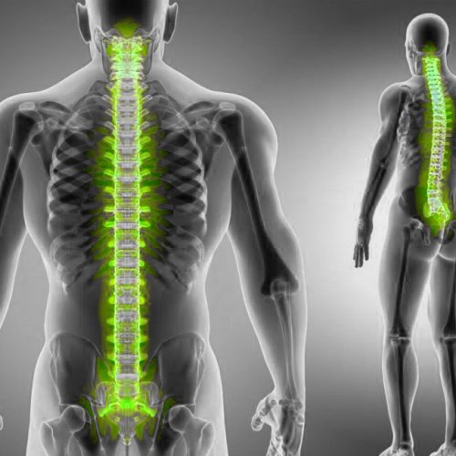 Osteoarthritis-Not-Just-Simple-Wear-and-Tear- آرتروز مفاصل؛ فقط ساییدگی ساده نیست